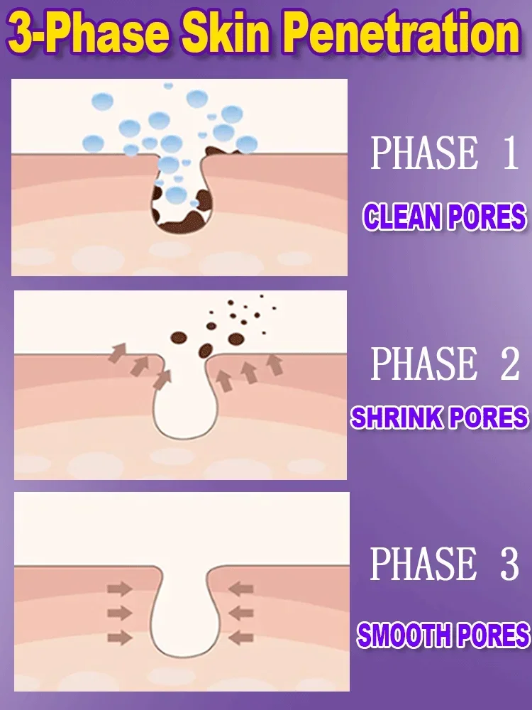 Huidtextuur | Porie Raffinage Resurfacing, Verheldering Van Gezichtsserum Met Retinol En Niacinamide Niet-Comedogeen