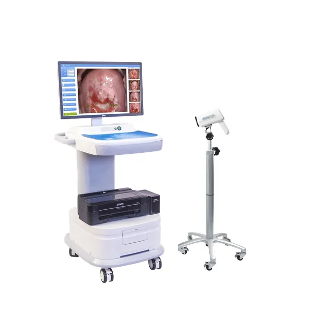 

Portable HD Colposcope Digital Video Colposcope Machine Gynecology Colposcope