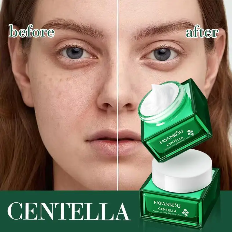 creme-rejuvenescedor-fayankou-com-centella-asiatica-para-pele-seca-e-Aspera-restaura-a-vitalidade-da-pele-e-repara-creme-calmante-e-reparador-para-a-pele