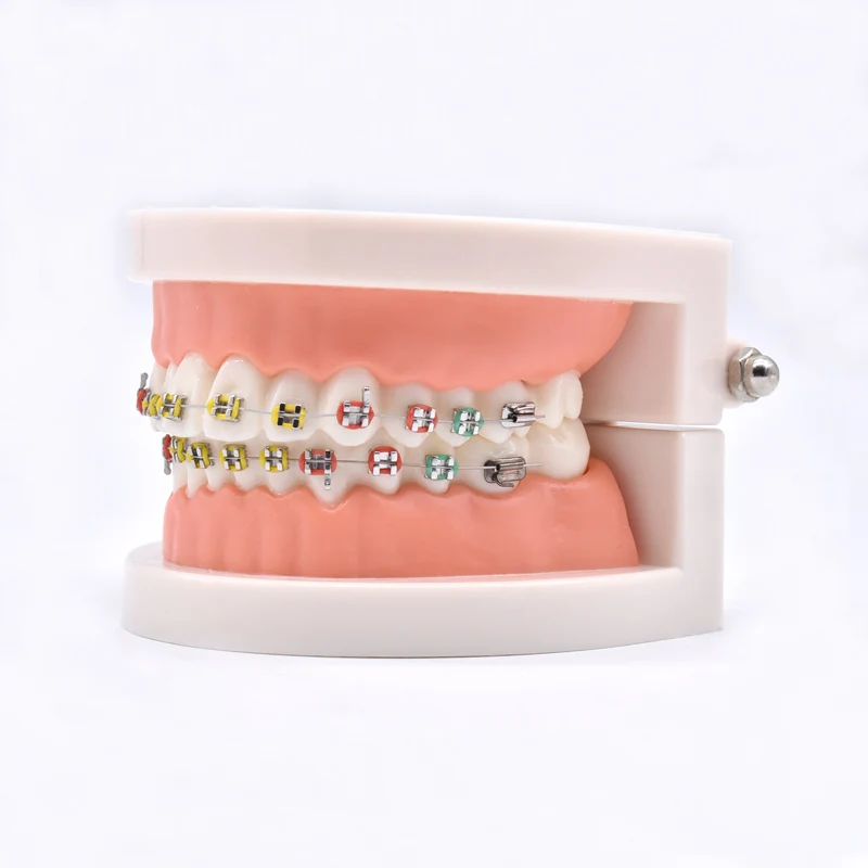 Dental Orthodontic Treatment Model With Ortho Metal Ceramic Bracket Arch Wire Buccal Tube Ligature Ties Dentist Lab Teaching Too