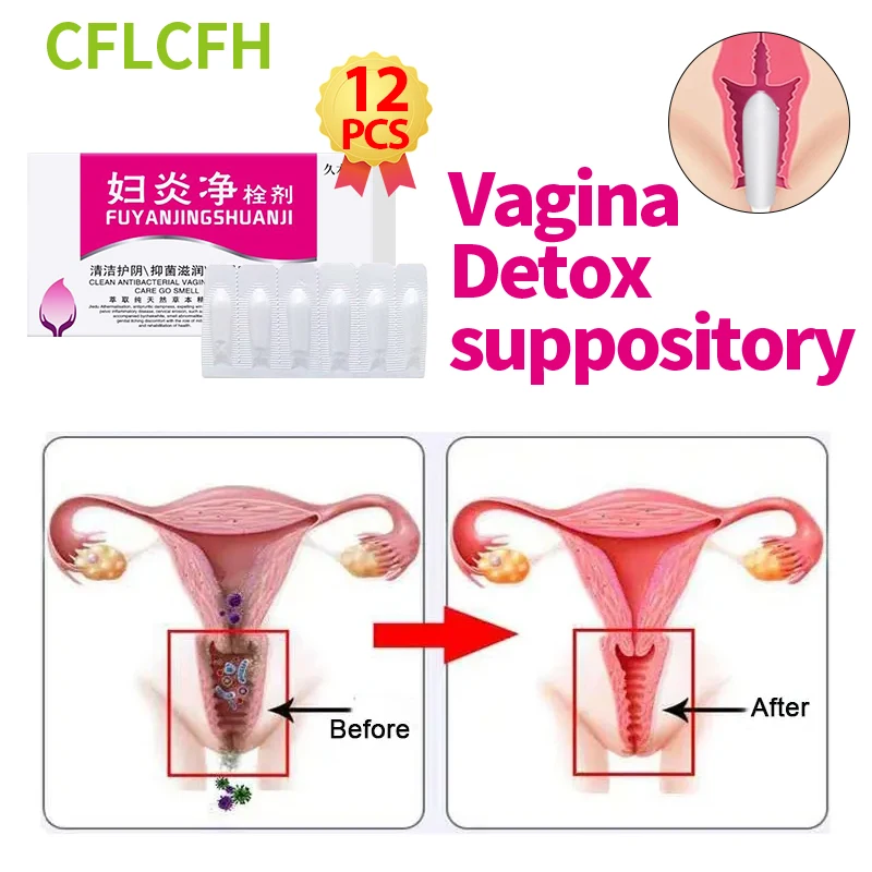 

Vaginal Womb Detox Vagina Cleaner Gynecological Care Suppository Vaginale Infection Women Vaginitis Treatment Feminine Hygiene