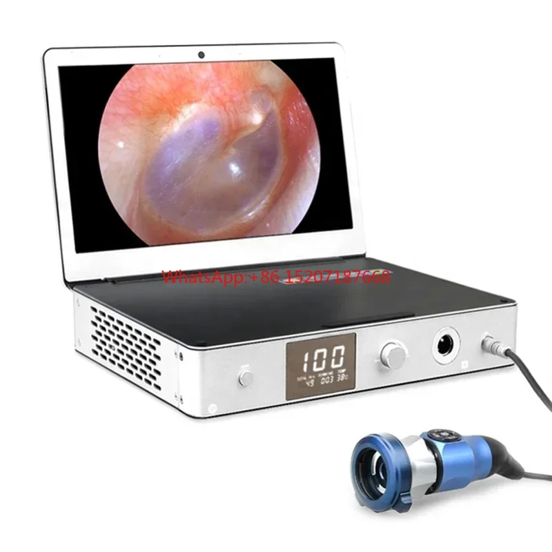 ALL IN ONE 12 Inches Screen Hd Portable Ent Endoscope With Led Light Source and HD Medical For