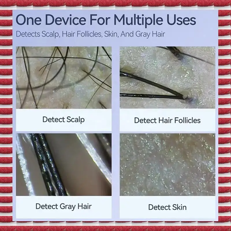 Dermatoscópio eletrônico profissional para análise de saúde da pele A97G - câmera digital para couro cabeludo e ferramenta de ampliação de poros