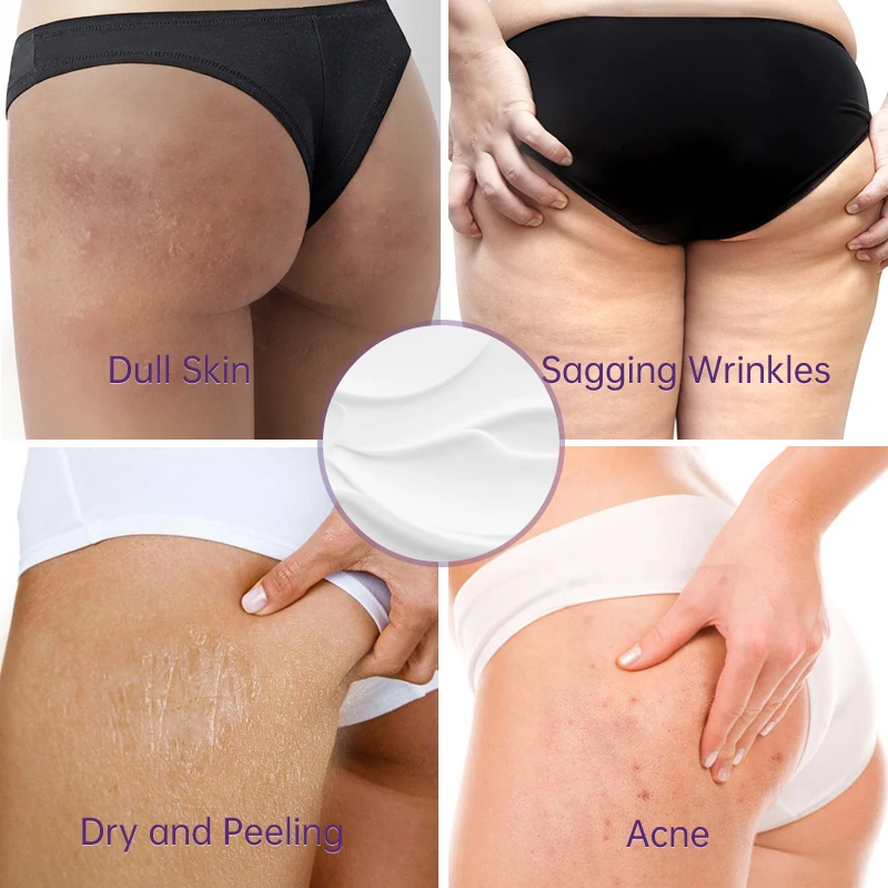 Body Whitening Cream Buttock Firming Moisturizing Sculpting Lifting Buttocks Smoothing Massage Lotion For Women Care Body Cream