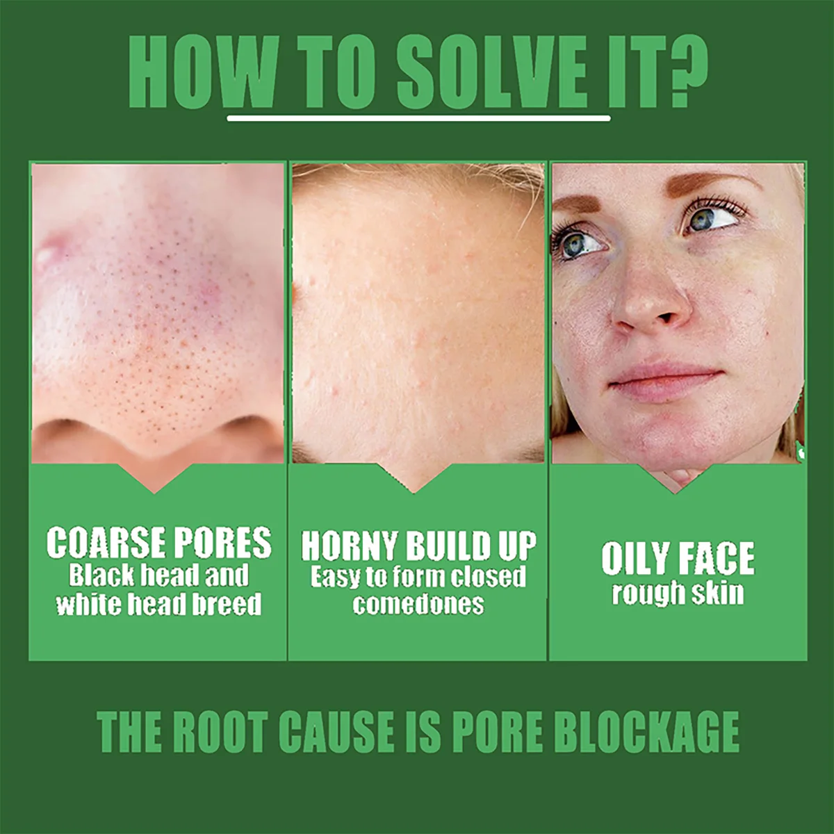 Shrink pores Remove acne marks Essential Oils Desalinate Stain Remove Pouch Licorice Facial Essence Reduces Wrinkles Acne