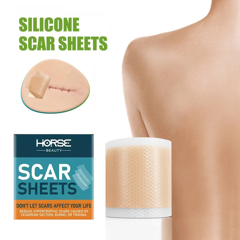 

150cm Silicone Gel Scar Sheet Patch Treatment Removal Tape Acne Trauma Burn Scar Cover Skin Repair