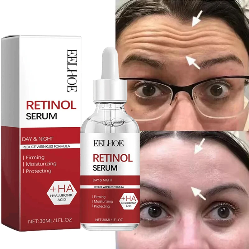 Retinol Összeráncol Folttisztószer arcon állítsa Folyó hó firming Emelés anti-aging Vérsavó Utána ereszt Rendbírság Írásbeli büntetés whitening Koreai Reve érdekel termékek