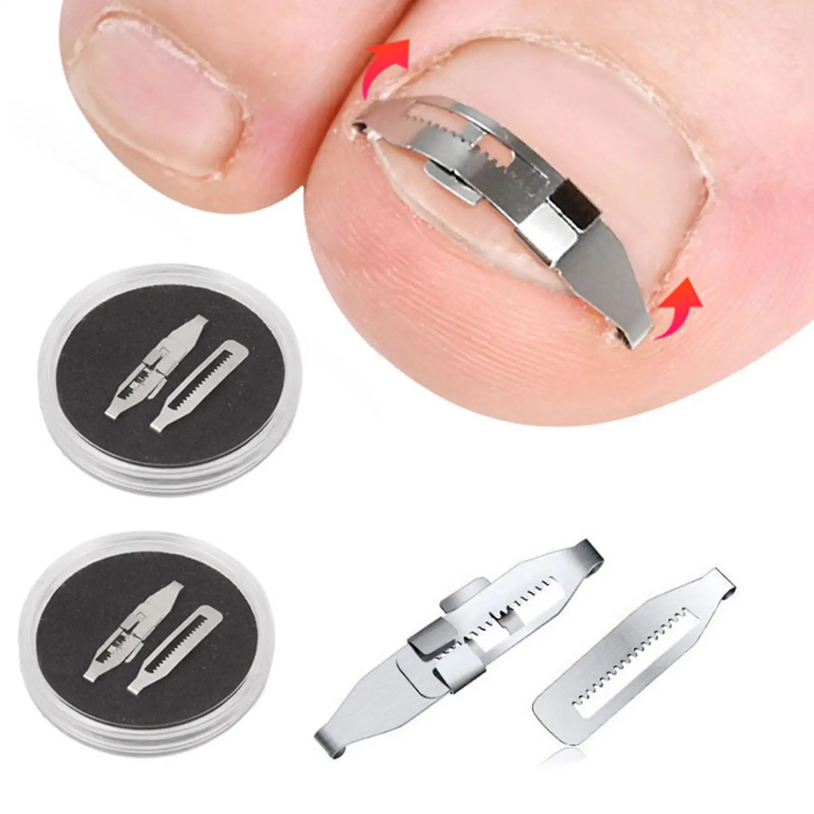 Ingrown Toenail Treatment Kit Carbon Steel Nail Corrector with Lifter for Pedicure Nail Care and Foot Health