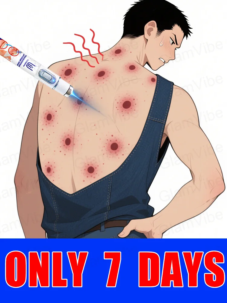 

blue light pen solve warts, hot sale wart care tools