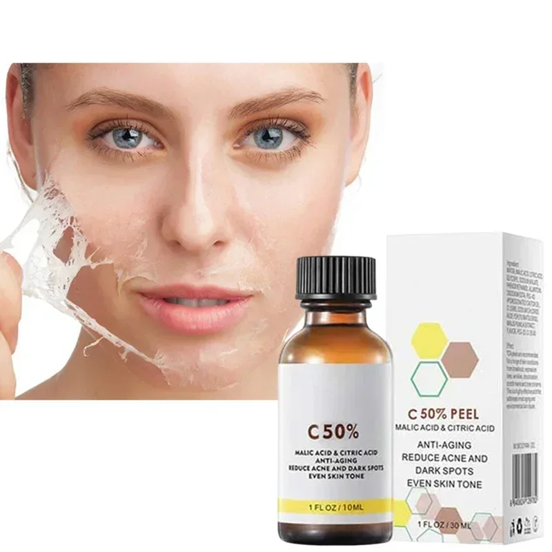 ¹ ᵁˢᴰ  Acid Peeling Serum Chemical Exfoliant Peel for remove Face Dark Skin Spots Whiten Lighten Melanin Peeling Solution Skin P