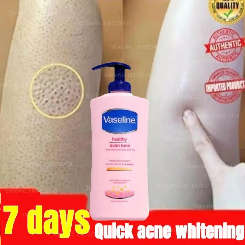 400ml Vaseline Body Milk Niacinamide Whitening Brightening Body Milk Autumn and Winter Improve Rough Chicken Skin Body Milk