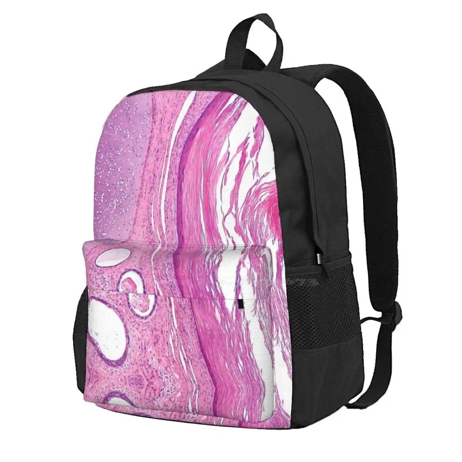 

Teratoma Histology Hot Sale Schoolbag Backpack Fashion Bags Teratoma Skin Teeth Hair Tumour Tumor Cancer Histology Histologist