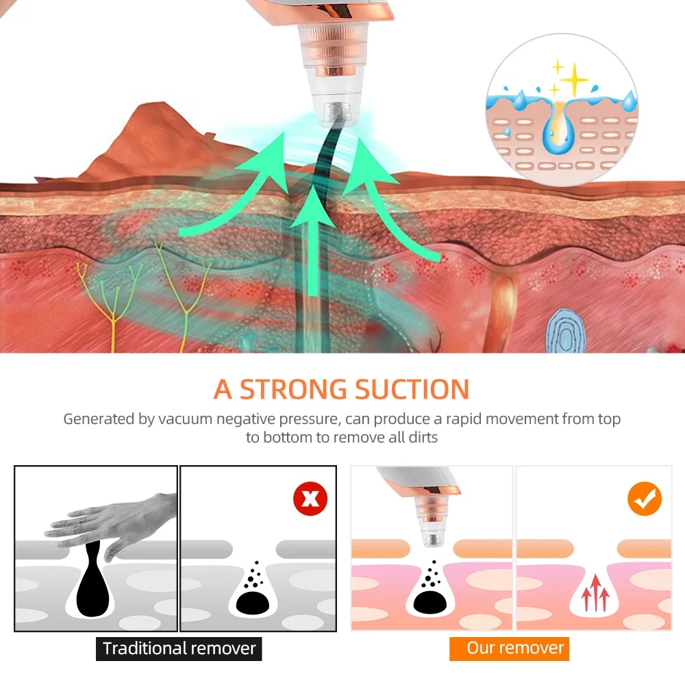 สูญญากาศจมูก Blackhead Remover ทําความสะอาดใบหน้าความงามเครื่องดูดสิว Dead Skin Remover EXTRACTOR Skin Care