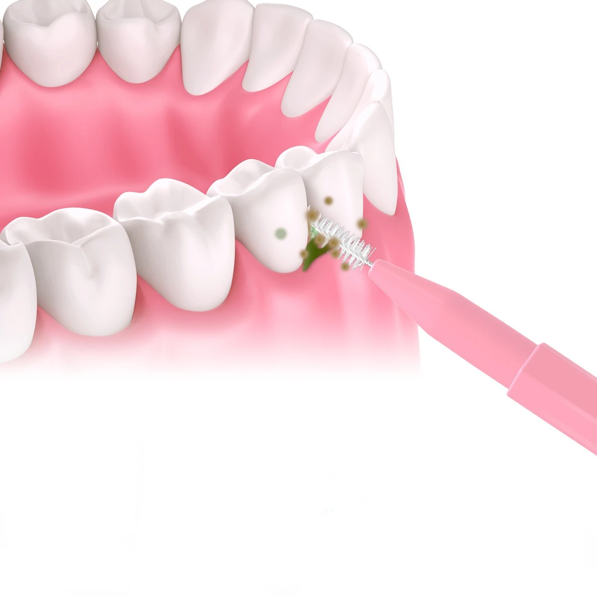 Escovas interdentais para cuidados de saúde, Escova dentária ortodôntica, Ferramenta de higiene oral, Limpadores interdentais, Escova, 30pcs