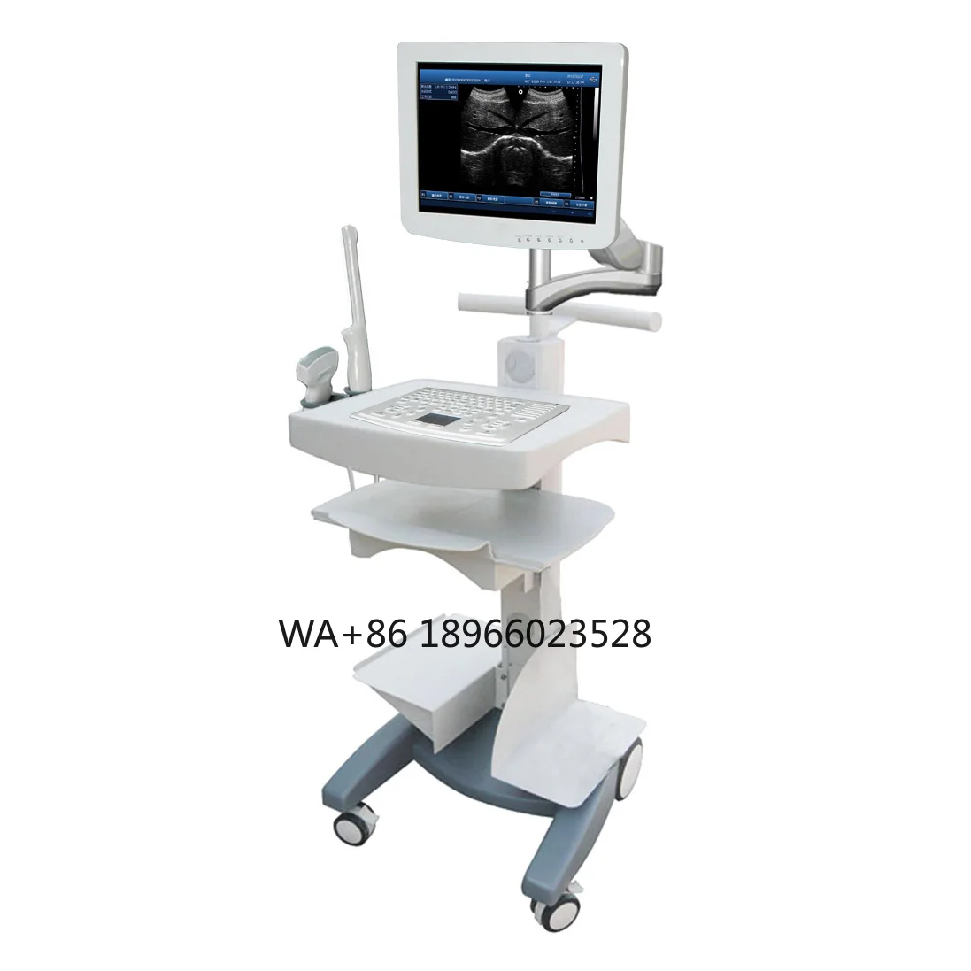 Medical Digital Gynecology 256 Level 15 Inch Touch Screen Trolley B/W Ultrasound Scanner System