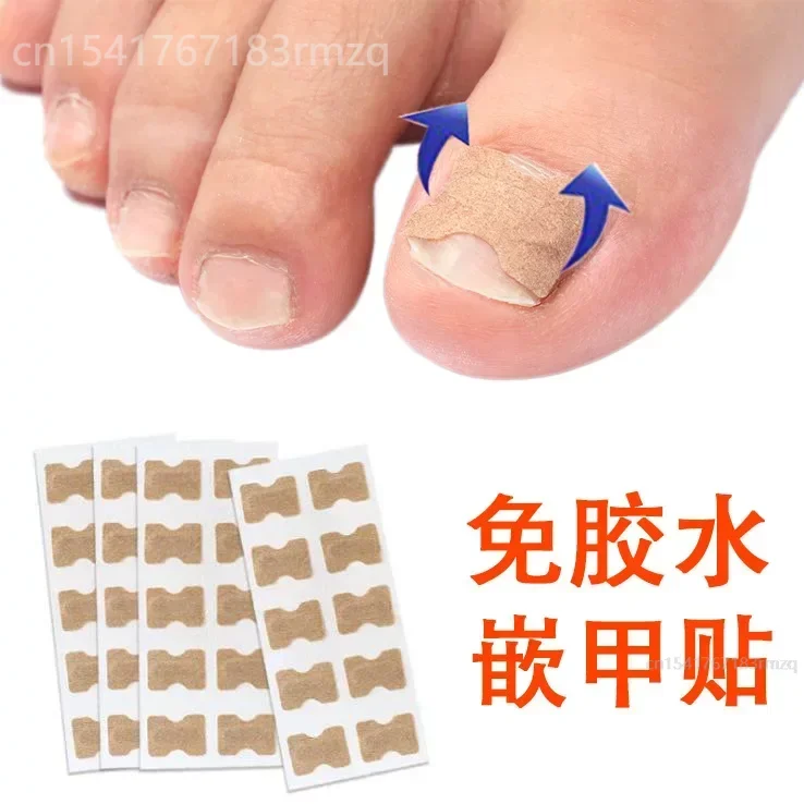 Nail Correction Stickers Ingrown Toenail Corrector Patches Treatment Recover Corrector Pedicure Care Tool foot massage  서큘레이터