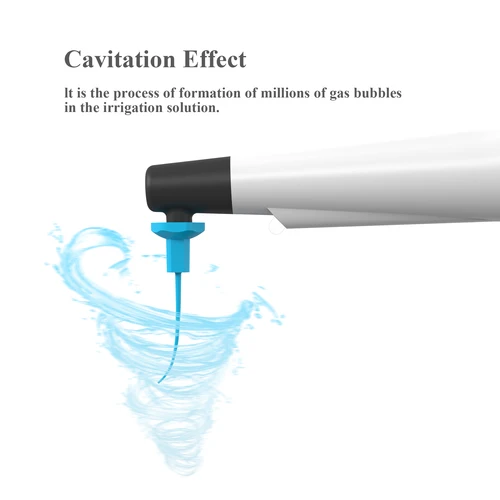 Imagen 2 del producto Activador de irrigador sónico de conducto radicular endodoncia VVDental LED con 60 uds de limas de puntas para instrumento de odontología de limpieza endodóntica