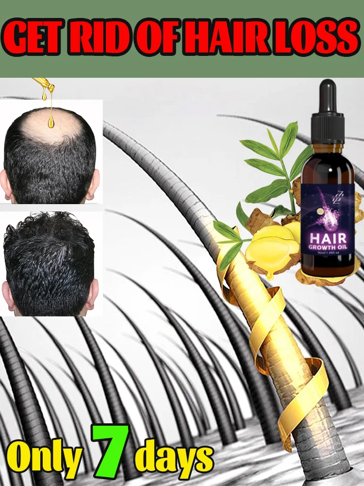 

Hair growth essential oil. Effectively repair baldness and hair loss symptoms
