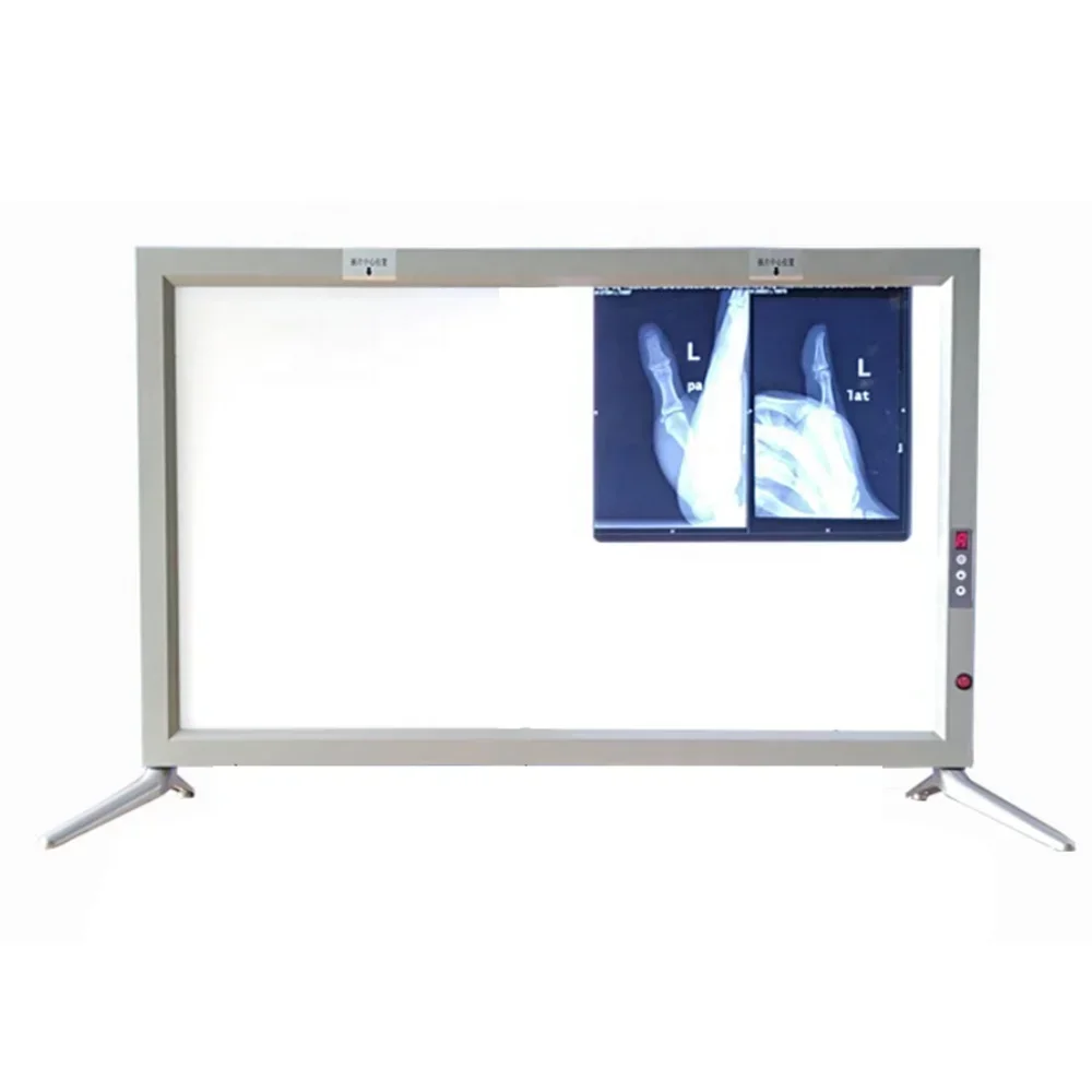 Adjustable Medical LED X Ray Imaging Film Viewer View Box Xray Viewer Panel Led Negatoscope