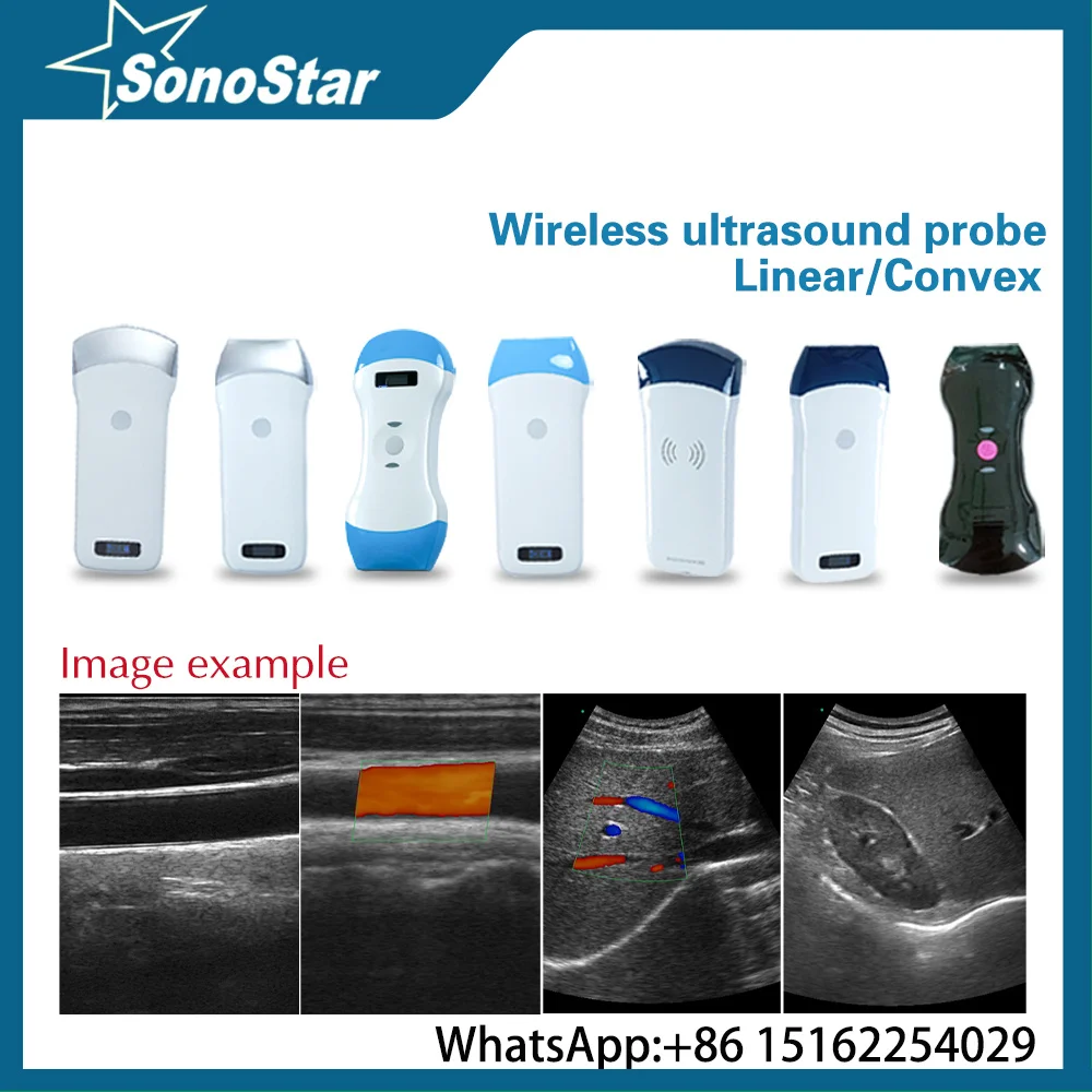 

Sonostar беспроводной ультразвуковой зонд сканер портативный WIFI линейный или выпуклый аппарат поддержка iOS Android Windows USG
