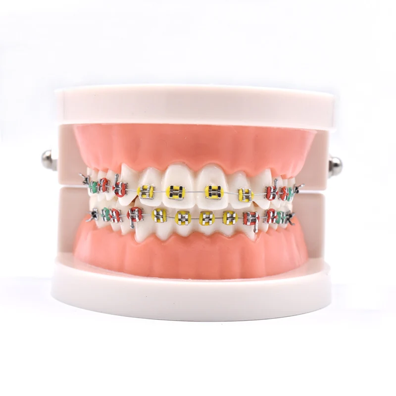 Dentystyczny Model leczenia ortodontycznego z ortopedycznym metalowym wspornikiem ceramicznym, drut łukowy, tubka dentystyczna również podwiązki