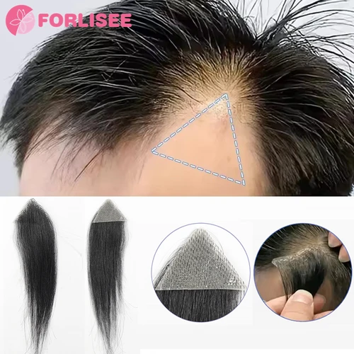 Imagen 1 del producto Parche para la frente, peluquín para patillas, Invisible, sin costuras, piel ultrafina, PU, línea de cabello para hombres, parche para patillas, parche para el cabello para cicatrices