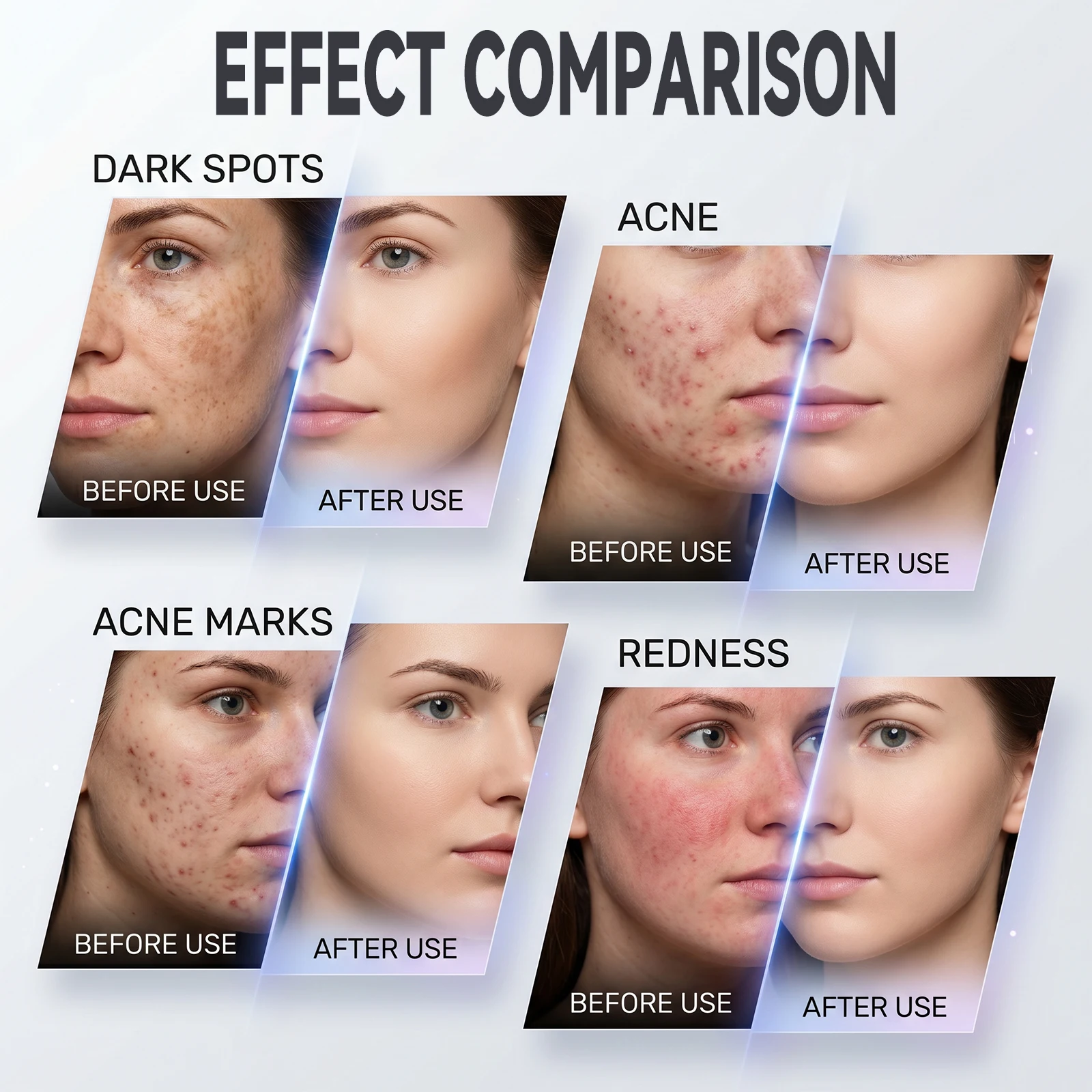 Podofo 10-in-1 Professionelles Gesichts-Schönheitsgerät Hydra Facial Maschine Hydrodermabrasion Aqua Peeling Sauerstoff-Jet Tiefenreinigung Hautstraffung Verjüngung Aufhellung Schönheitsmaschine Salon SPA Hautpflegegerät – Detail 4