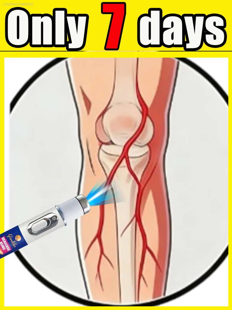 

Blue light pen for quick removal