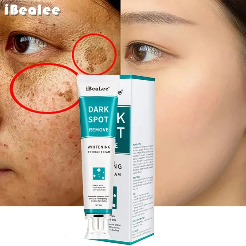 Whitening Freckle Cream Remove Dark Spots Remove Melasma Anti Freckle Cream Fade Pigmentation Anti-Aging Light Skin Care