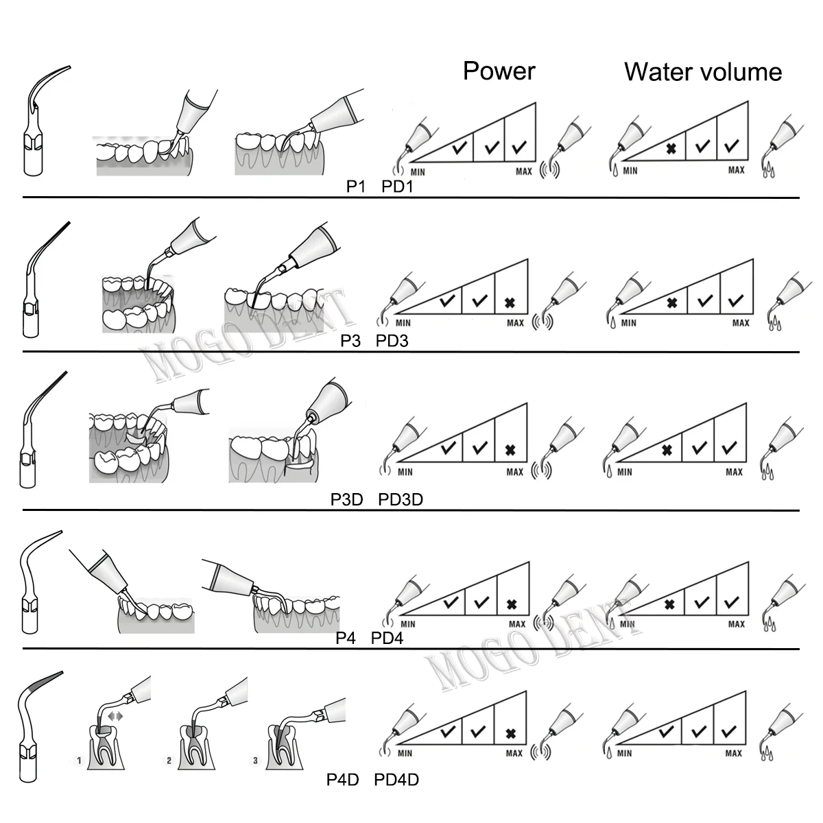 Woodpecker Dental Ultrasonic Scaler Tips Dental Periodontics Tips  P1-P4D Fit EMS UDS Scaler Handpiece Dentistry Tools