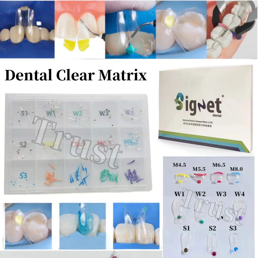 

150pcs/Kit Dental Clear Matrix Diastema BT Black Triangle Matrices Wedges Similar with BioClear Matrice Fits BioClear