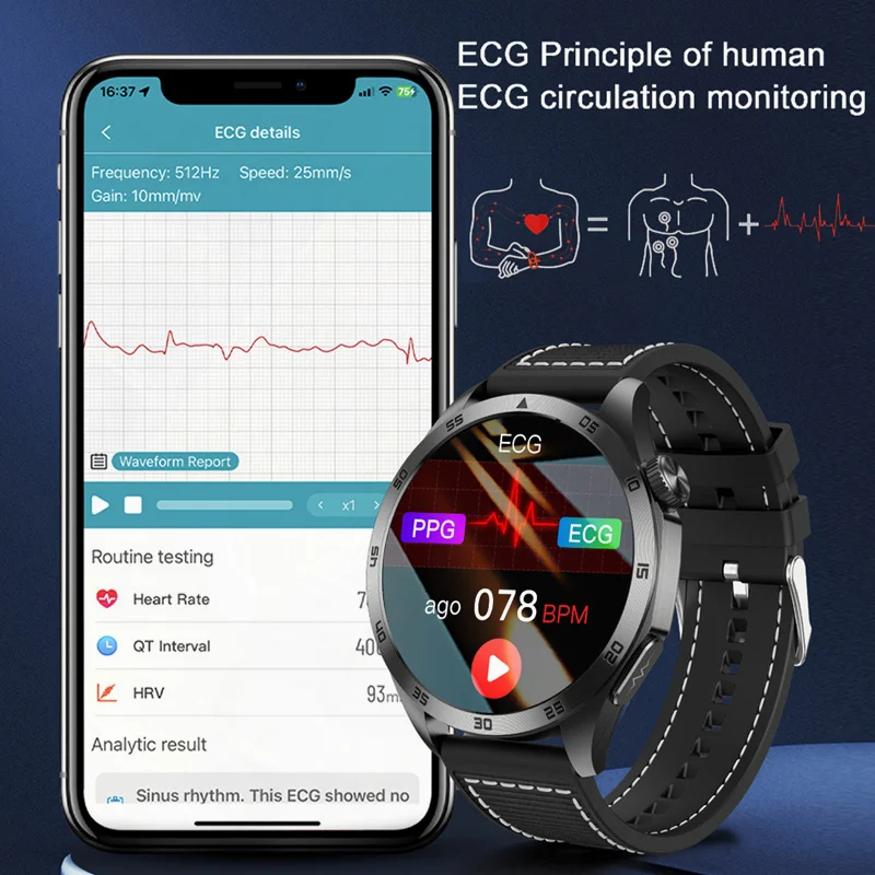 Relógio inteligente de glicose sanguínea para homens, Relógios ECG, Lipídios sanguíneos, Ácido úrico, Chamada Bluetooth, Smartwatch de saúde,