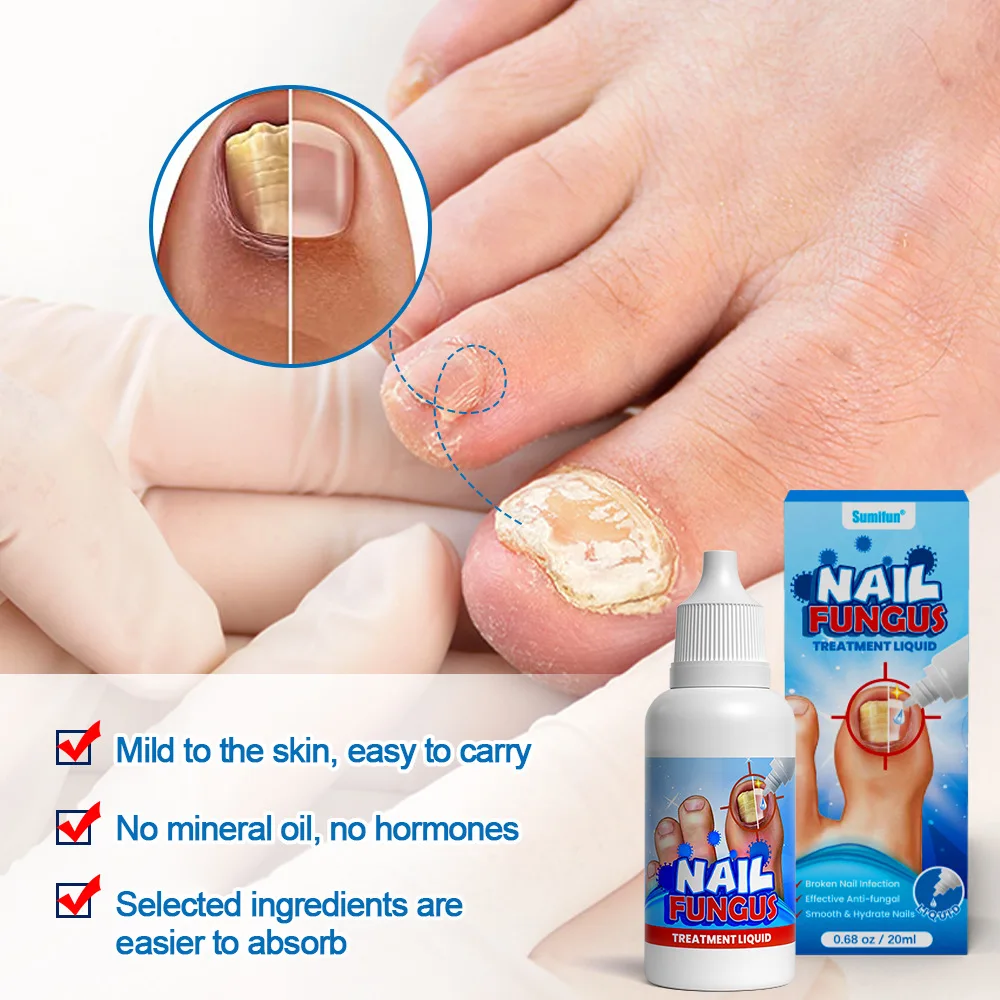 Crema de renovación de Uñas, bálsamo Natural Extra fuerte para Uñas, tratamiento de hongos para Uñas descoloridas