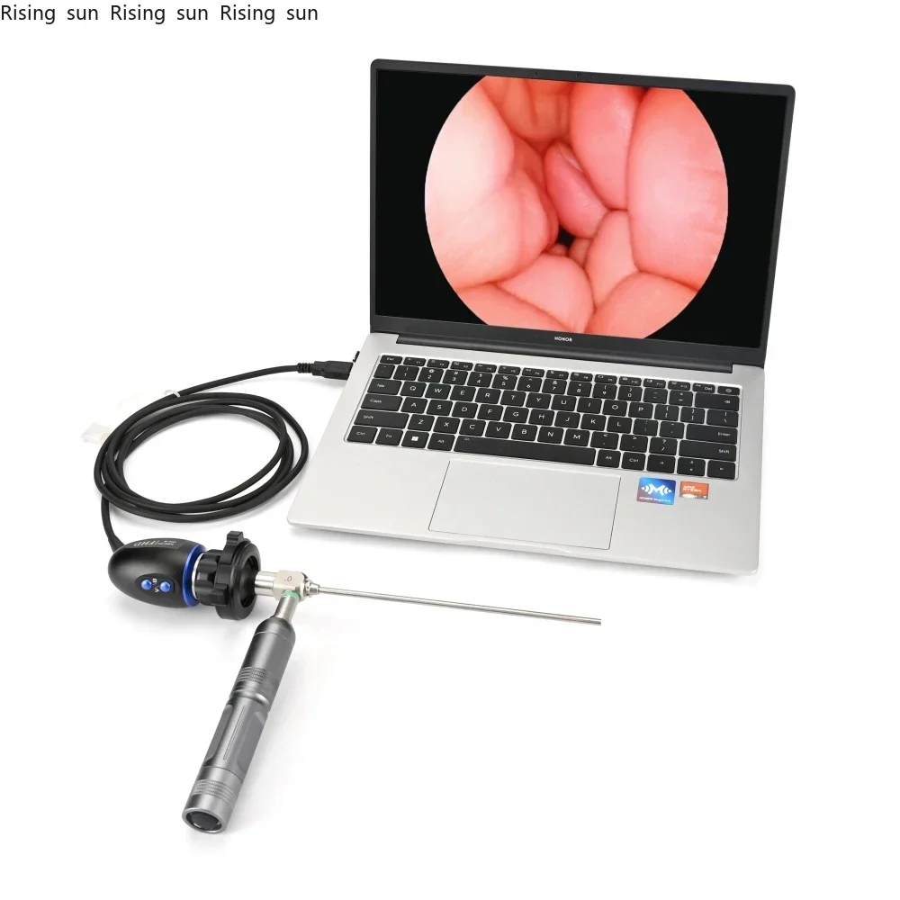 

Medical Handheld FHD 1080P USB ENT NEW with Record Function for ENT Endoscopy Surgery