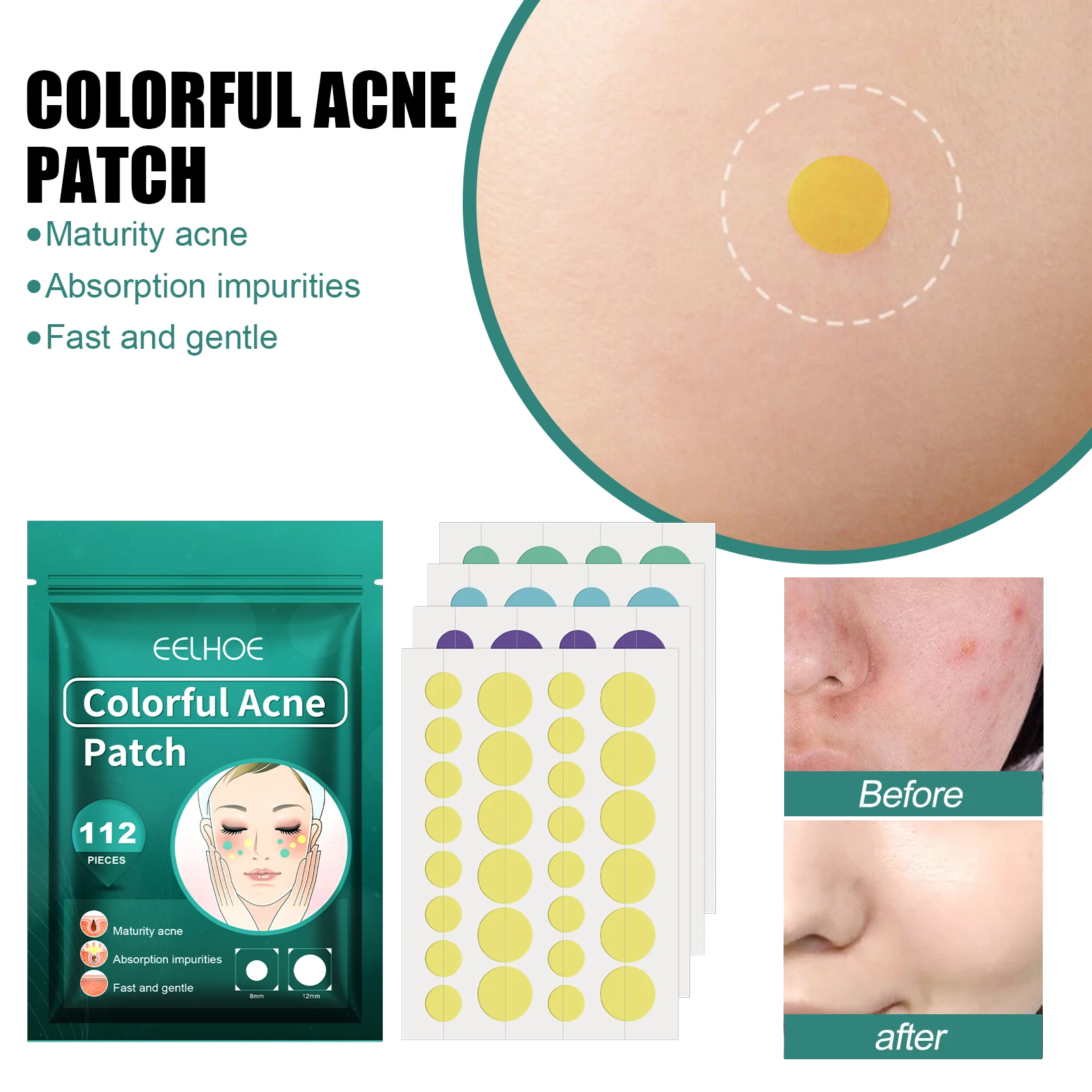 

Красочные пластыри от прыщей, наклейки от прыщей для ухода за лицом, балансировка масла, очищение пор