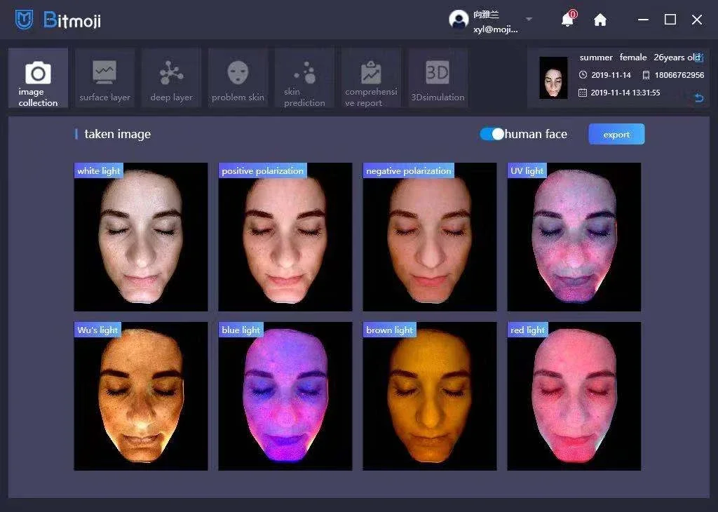 Visia Display LCD Analisador De Pele Inteligente, Máquina Facial, Sistema De 6 Linguagem, 3D, 4D, Venda Quente, 12,7"