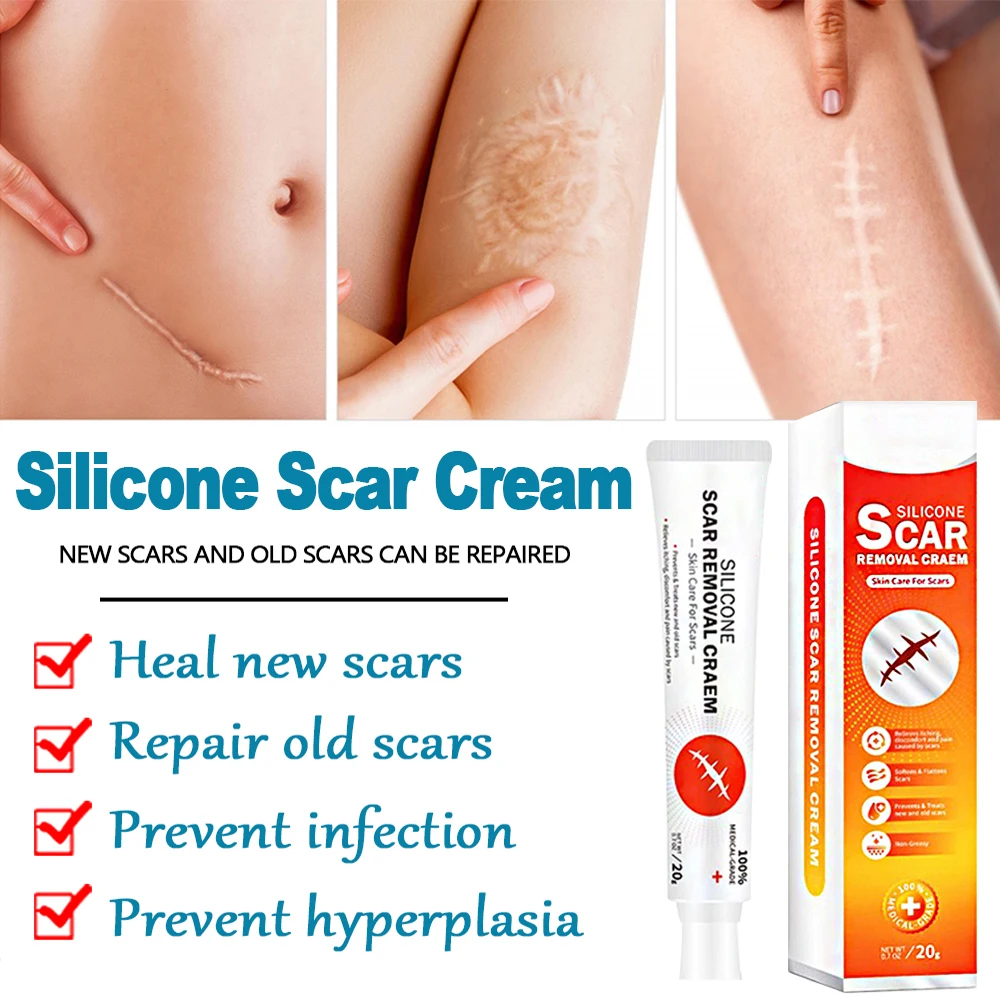 Scar Removal Cream Remove Acne Spots Treatment Stretch Marks Burn Surgical Scar Smoothing Whitening Pigmentation Care