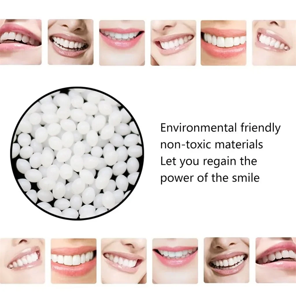 Sdotter New 20/100g Resin Tooth Repair Glue Shapeable Teeth Gaps Filling Solid Temporary Teeth Repair False Teeth Glue Safety De