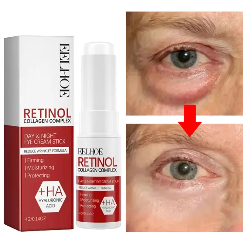 

Retinol Eye Bag Remove Eye Cream Anti Fat Particles Dark Circles Puffiness Fade Fine Lines Lift Brighten Korean Beauty Eye Care