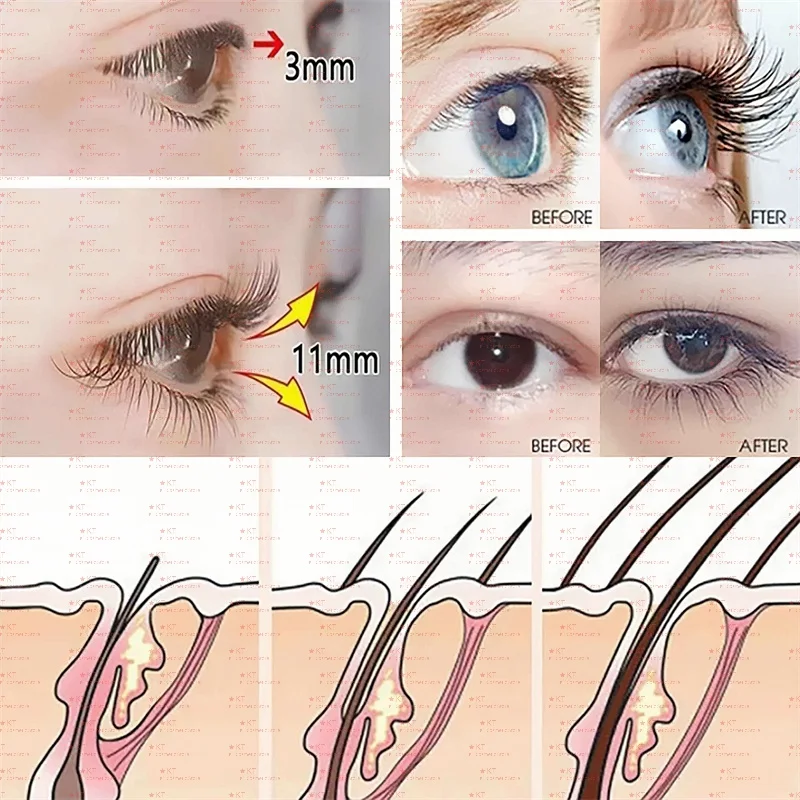 Fast Eyelash Growth Serum Eyebrow Hair Growth Anti Hairs Loss Product Prevent Baldness Fuller Thicker Lengthening Eyebrow Makeup