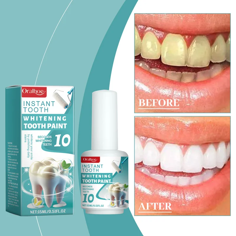 

Teeth Cleaning Coating - Effective For Tooth Stains, Odor, Dirt Removal, Dental Protection & Freshness Oral Care Solution