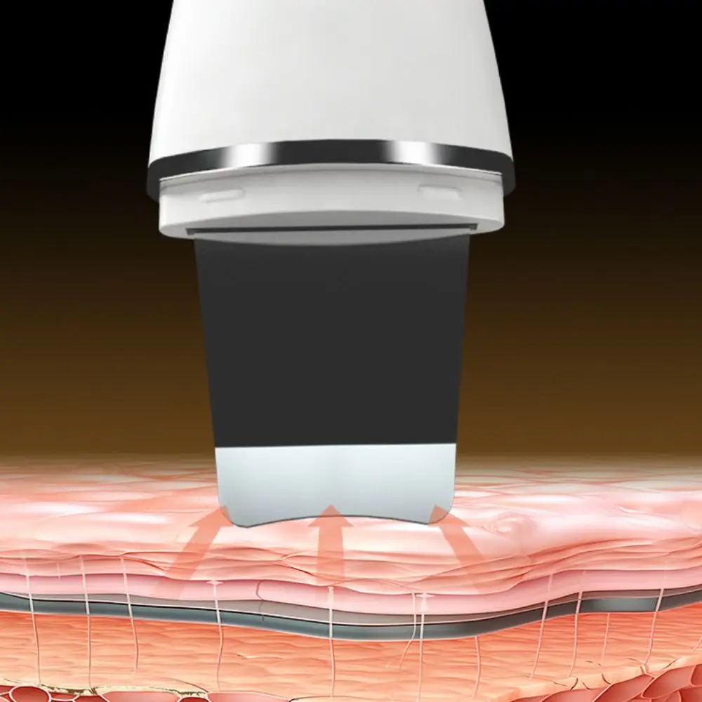 Tecnologia de íon purificador ultrassônico da pele limpeza profunda do rosto levantamento facial ultra-sônico peeling dispositivo cuidados com a pele recarregável usb