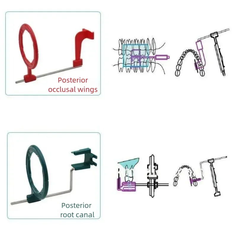 

Multifunctional Intraoral X-Ray Film Positioning System Dental Sensor Holder Position Kit for Dentists - Film Positioning Tools