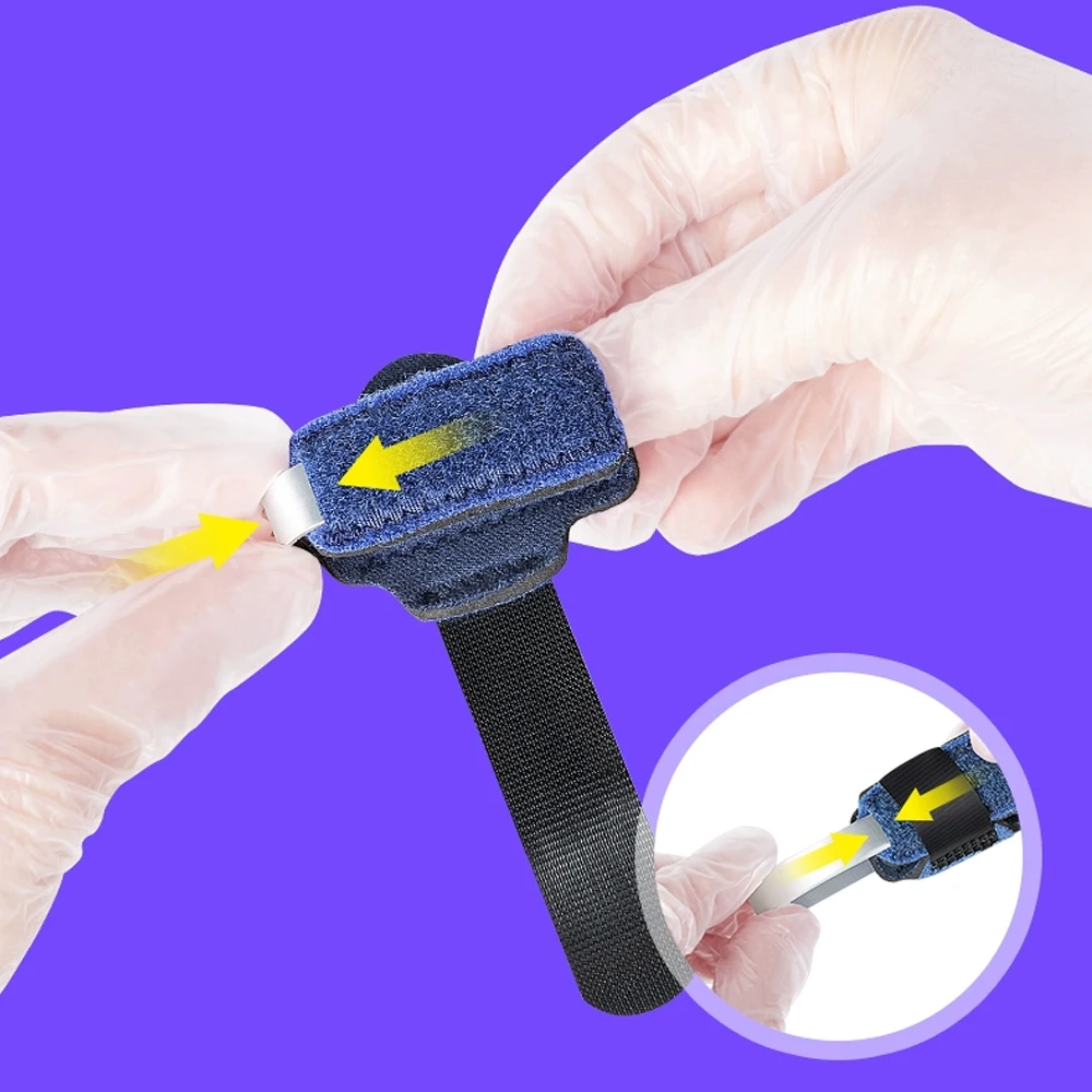 Tala de dedo do pé alisador para martelo corretor de dedo do pé unissex cinta de dedo do pé martelo tala envoltório cobre cinta fixa quebrada