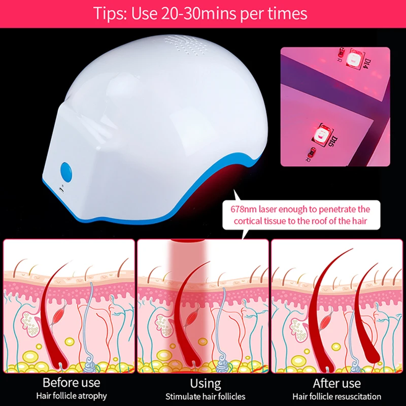 272 Diodes 678nm Wavelength Laser Hair Growth Helmet USB Rechargeable Hair Therapy For Hair Regrowth and Hair Loss Treatment