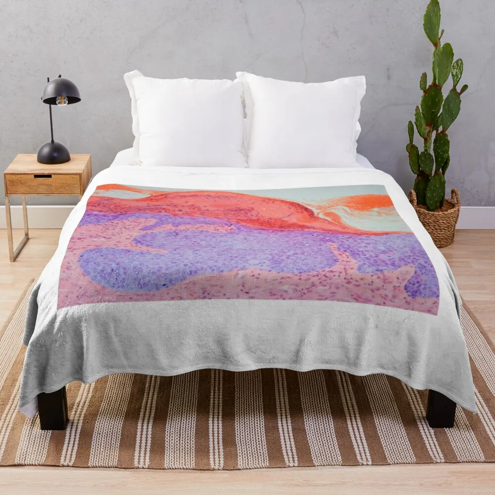 

Skin cancer, light micrograph (C021/6148) Throw Blanket Giant Sofa Sofas funny gift Soft Beds Blankets