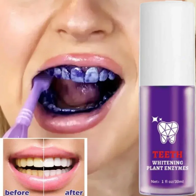 

Korean Teeth Cleansing Whitening V34 Toothpaste: Stain & Yellow Removal, Fresh Breath, Deep Clean & Whitening, Oral Care