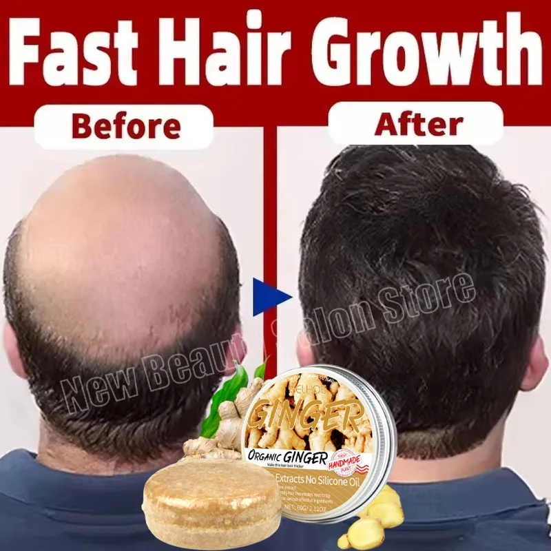 Gengibre crescimento do cabelo soro sabão recrescimento reparação do cabelo nutrir raiz anti perda de cabelo produtos de tratamento para homens mulheres cuidados com o cabelo