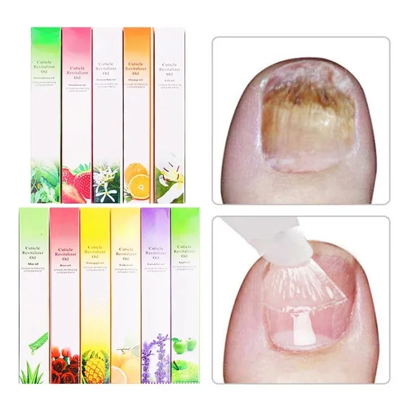 15 Smells Nail Nutrition Oil Pen Nail Treatment Cuticle Revitalizer Oil Prevent Agnail Nail Polish Nourish Skin