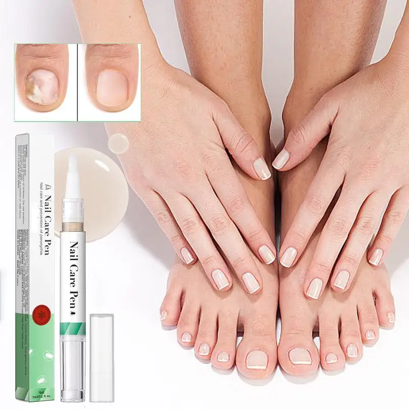 เล็บโภชนาการน้ํามันปากกาวิตามิน Cuticle Revitalizer น้ํามันเล็บ Edge Barbs Cuticle Revitalizer ปากกาเล็บ Cuticle Oil ปากกา